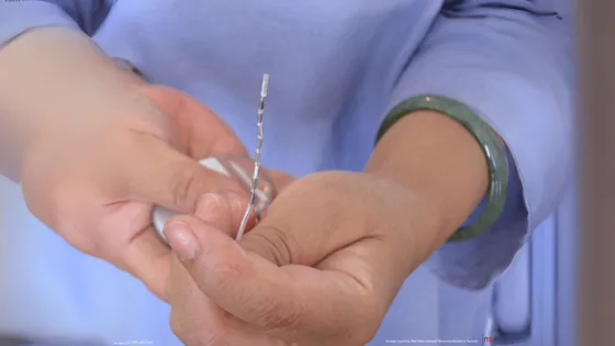 Neuromodulation